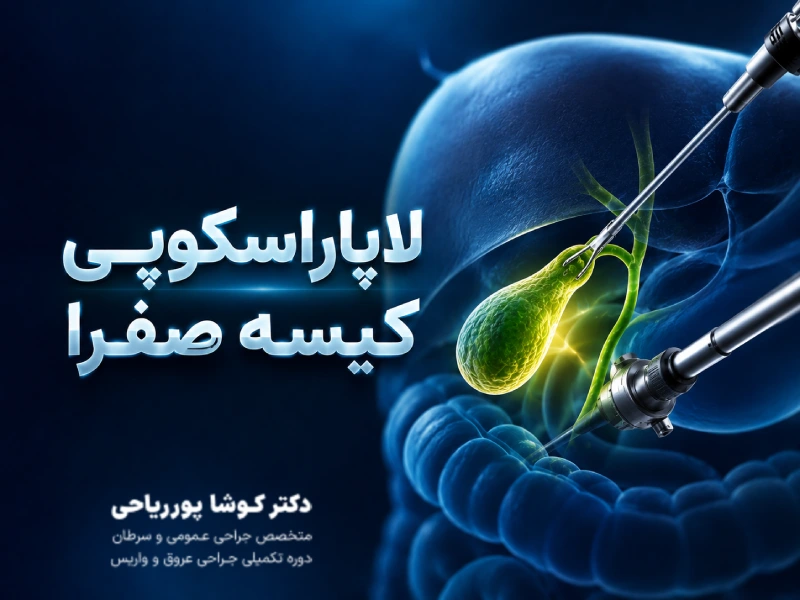 لاپاراسکوپی کیسه صفرا