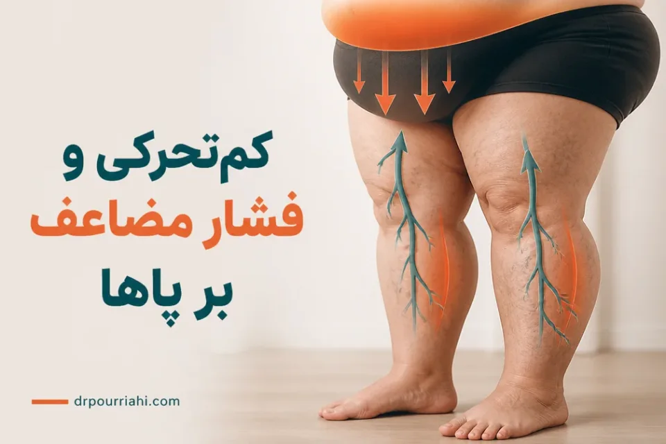 نمای توضیحی درباره کمتحرکی و فشار مضاعف بر پاها