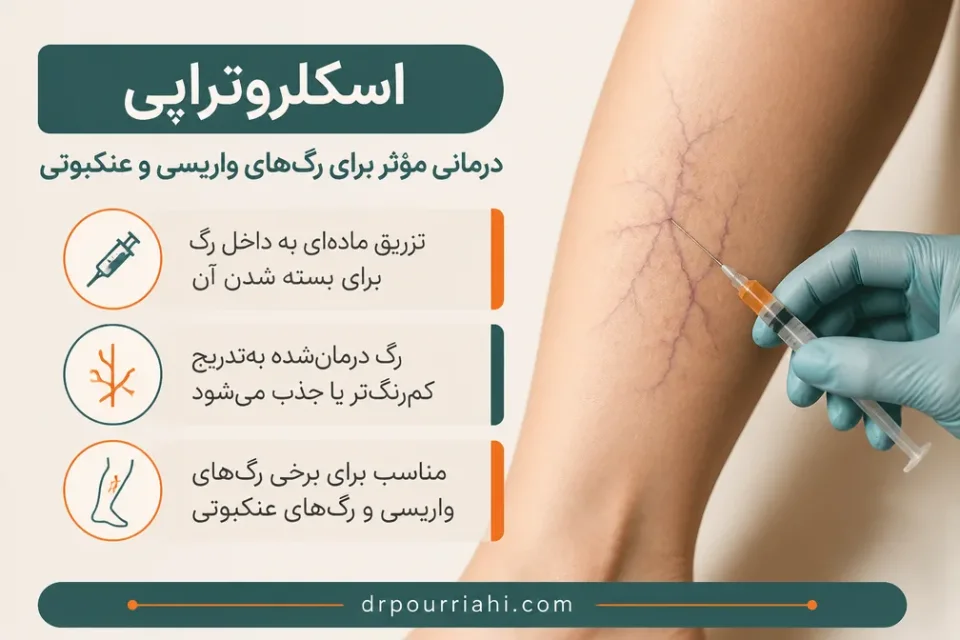 نمای توضیحی درباره اسکلروتراپی