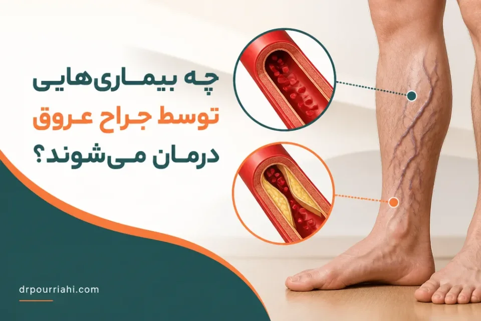نمای توضیحی درباره چه بیماریهایی توسط جراح عروق درمان میشوند