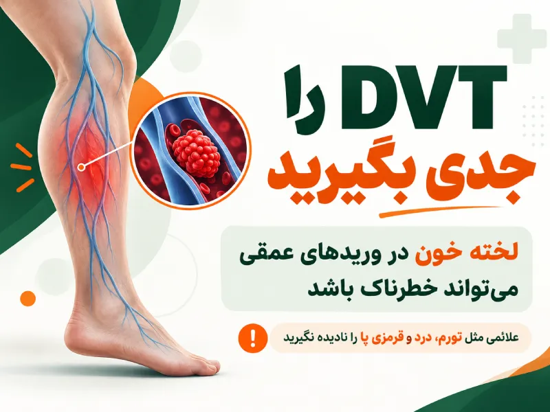DVT