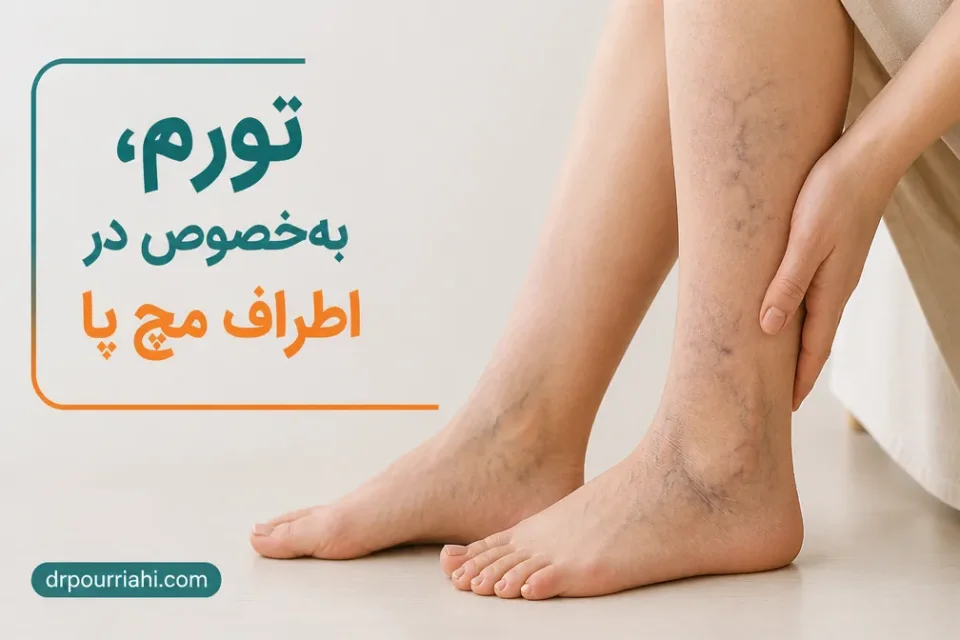 نمای توضیحی درباره تورم، بهخصوص در اطراف مچ پا