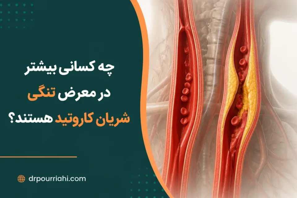 چه کسانی بیشتر در معرض تنگی شریان کاروتید هستند — مقایسه شریان کاروتید سالم با شریان دچار پلاک و تنگی